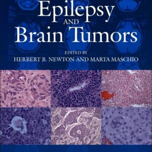 Epilepsy and Brain Tumors