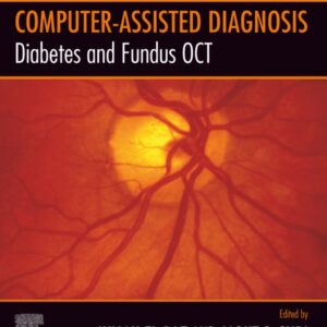 Diabetes and Fundus OCT (Computer-Assisted Diagnosis)
