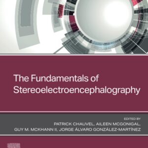 The Fundamentals of Stereoelectroencephalography