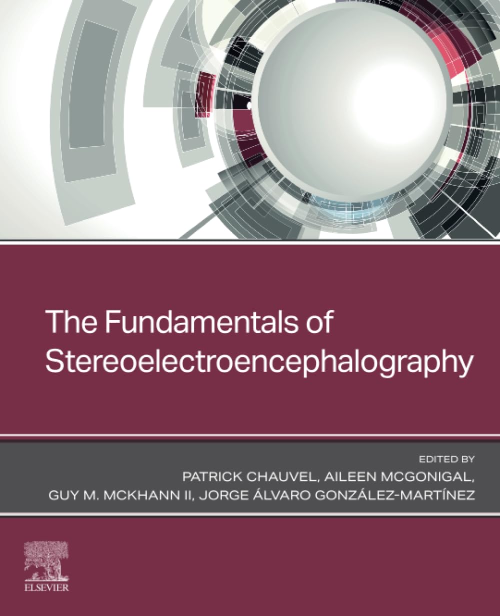 The Fundamentals of Stereoelectroencephalography