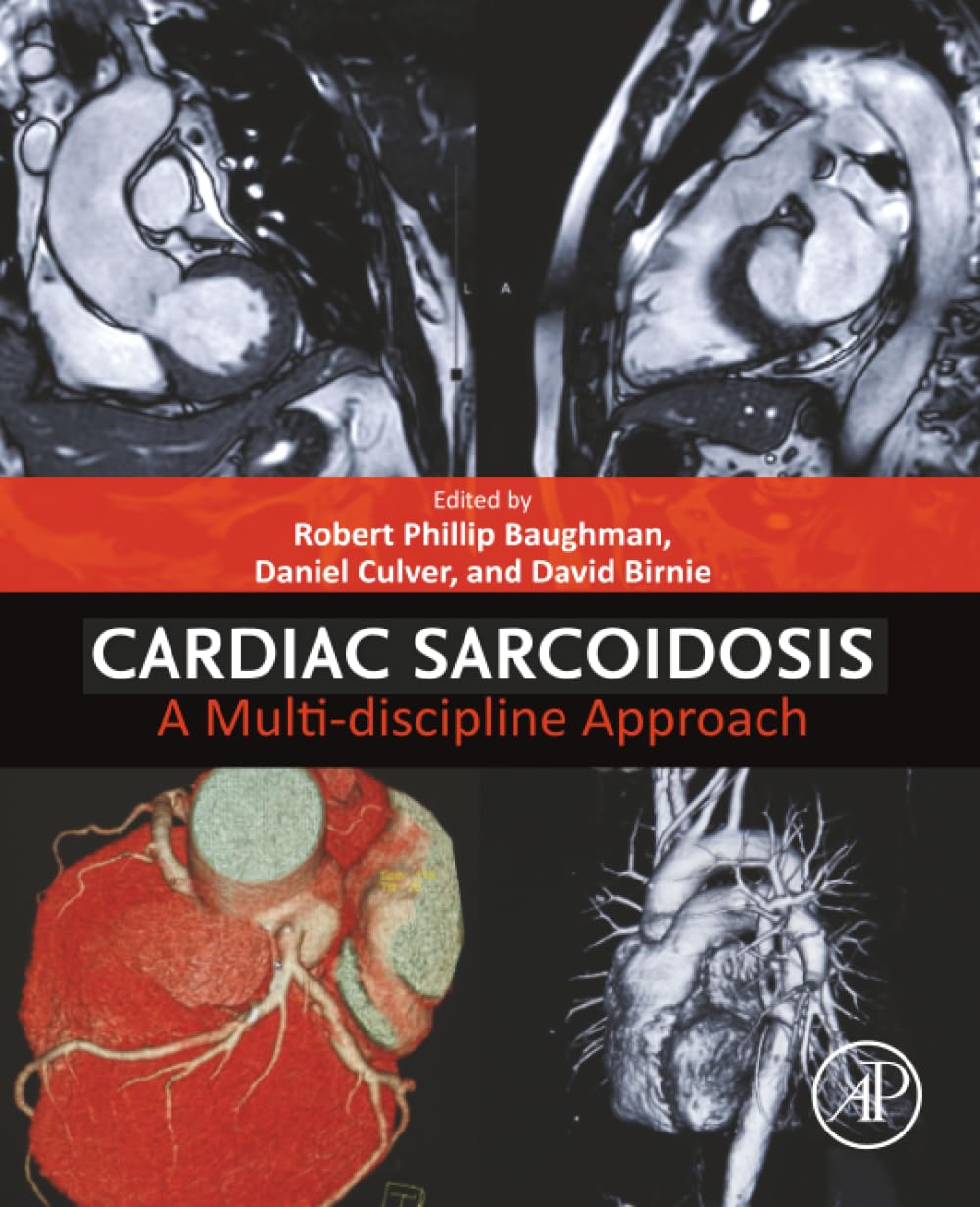 Cardiac Sarcoidosis: A Multi-discipline Approach