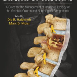 Osteomyelitis and Discitis of the Spine: A Guide for the Management of Infectious Etiology of the Vertebral Column and Neurological Components