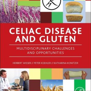 Celiac Disease and Gluten: Multidisciplinary Challenges and Opportunities
