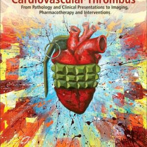 Cardiovascular Thrombus: From Pathology and Clinical Presentations to Imaging