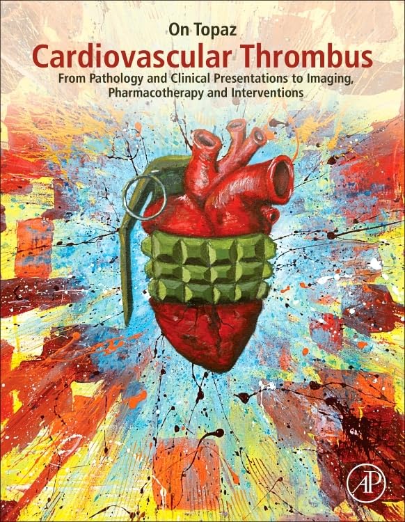 Cardiovascular Thrombus: From Pathology and Clinical Presentations to Imaging