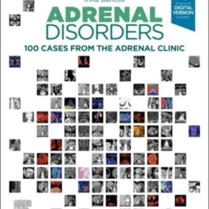 Adrenal Disorders: 100 Cases from the Adrenal Clinic
