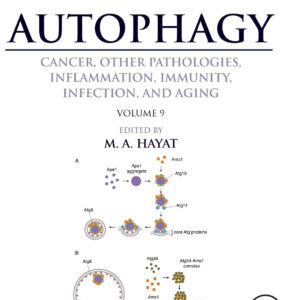 Autophagy: Cancer