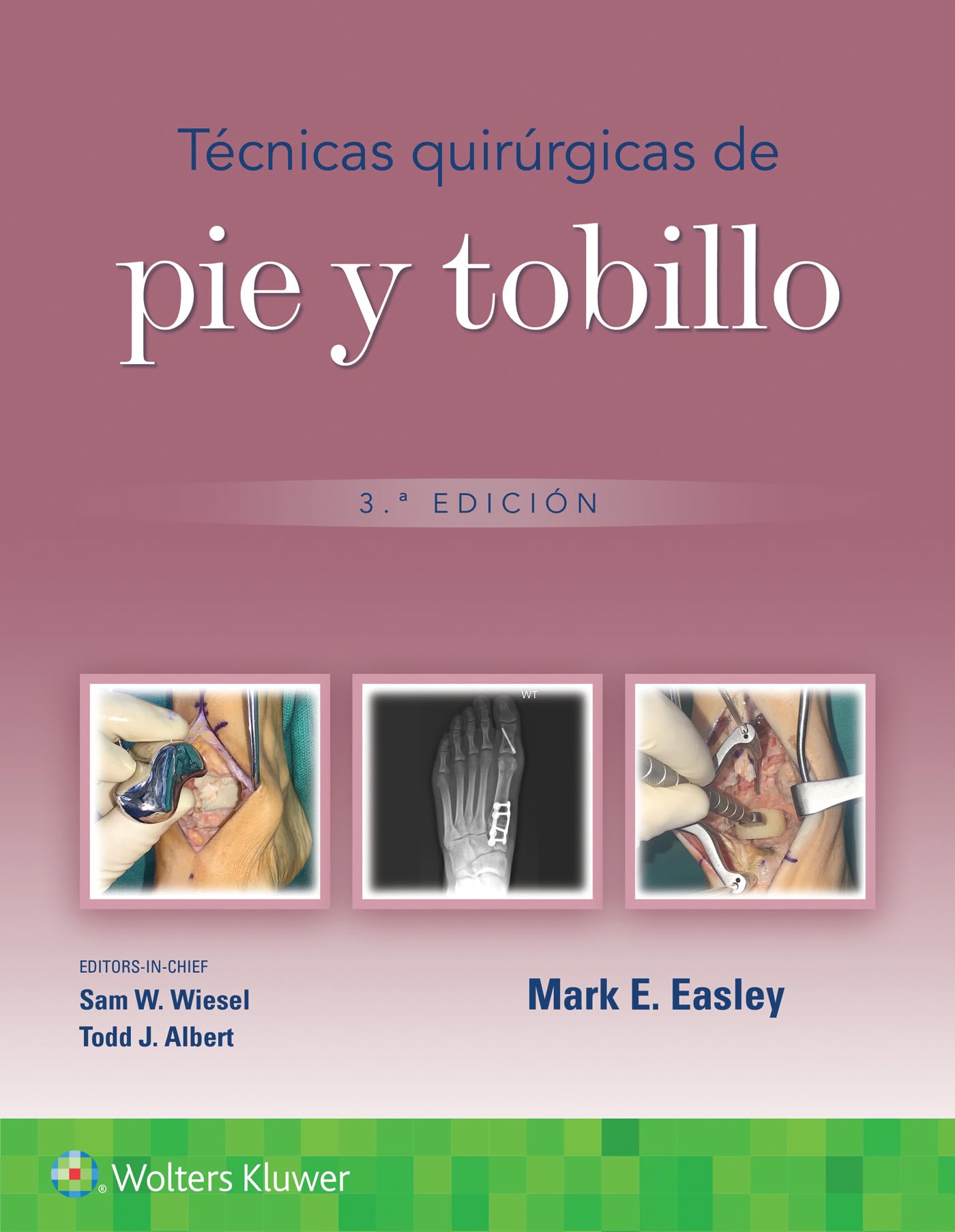 Técnicas quirúrgicas de pie y tobillo (Spanish Edition)-ISBN: 9788419663283