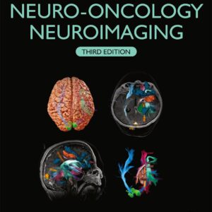 Handbook of Neuro-Oncology Neuroimaging