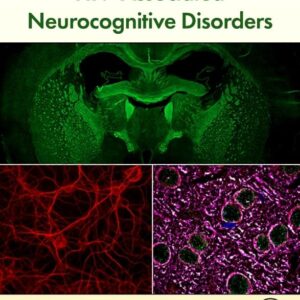 HIV-Associated Neurocognitive Disorders