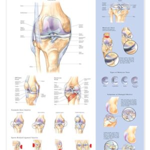 Knee Injuries Anatomical Chart-ISBN: 713012989552