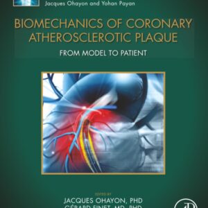Biomechanics of Coronary Atherosclerotic Plaque: From Model to Patient (Volume 4) (Biomechanics of Living Organs