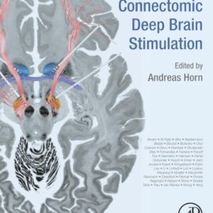 Connectomic Deep Brain Stimulation