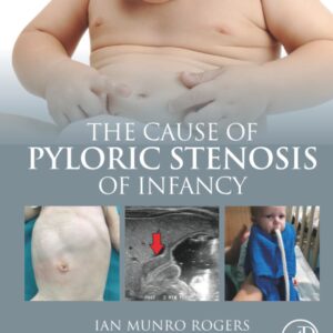 The Cause of Pyloric Stenosis of Infancy