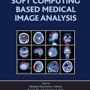 Soft Computing Based Medical Image Analysis