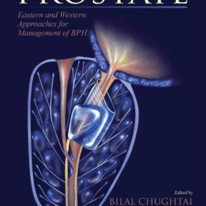 A Comprehensive Guide to the Prostate: Eastern and Western Approaches for Management of BPH