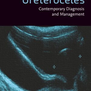 Ureteroceles: Contemporary Diagnosis and Management
