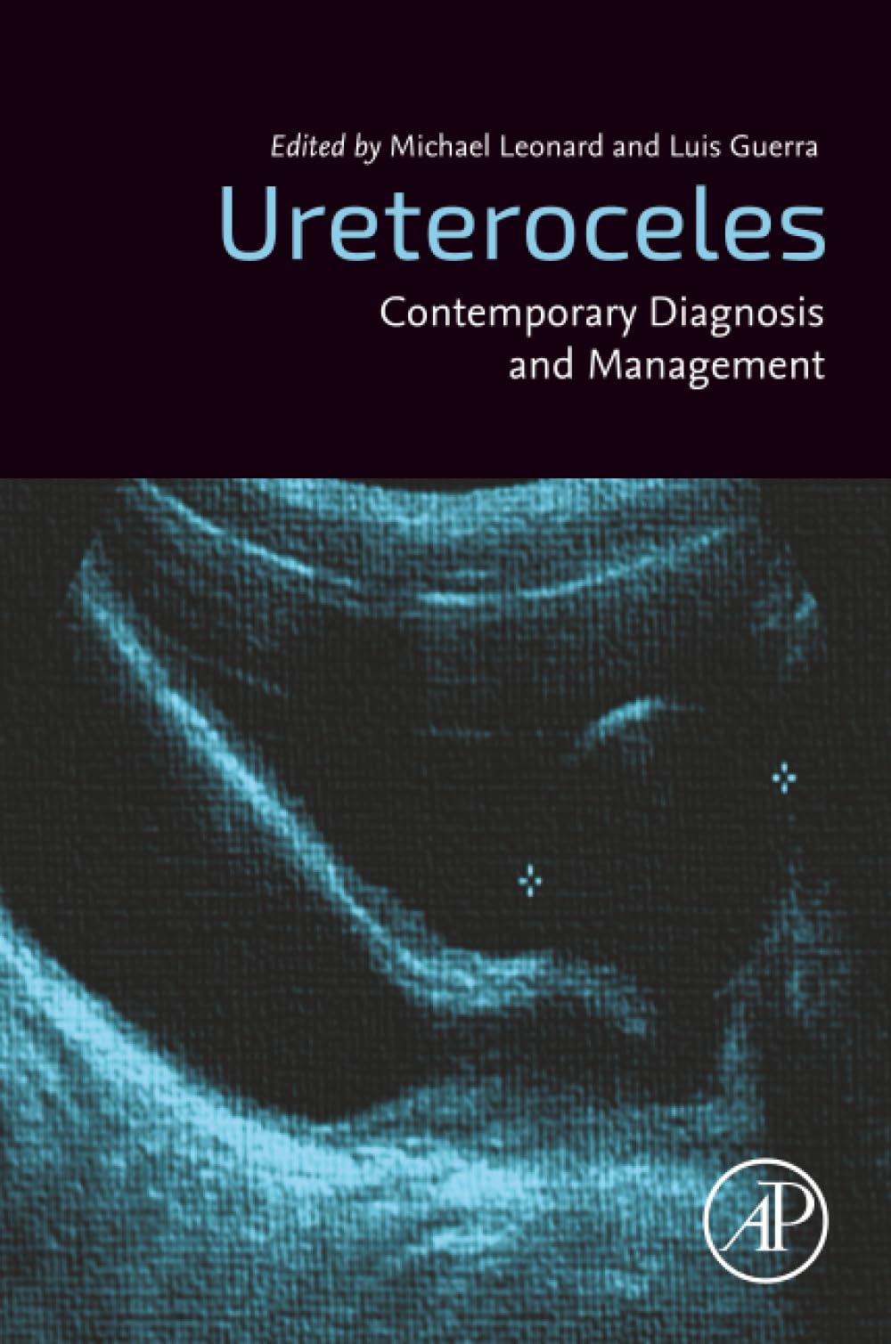 Ureteroceles: Contemporary Diagnosis and Management