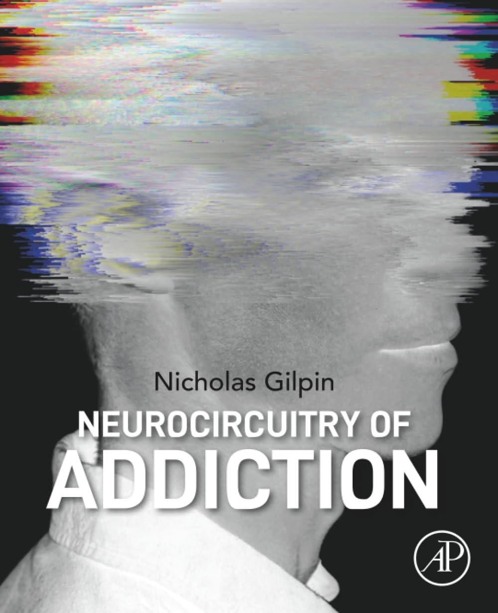 Neurocircuitry of Addiction