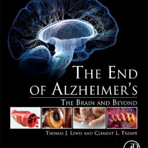 The End of Alzheimerâ€™s: The Brain and Beyond