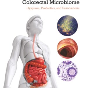 Colorectal Neoplasia and the Colorectal Microbiome: Dysplasia