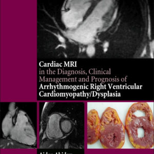 Cardiac MRI in Diagnosis