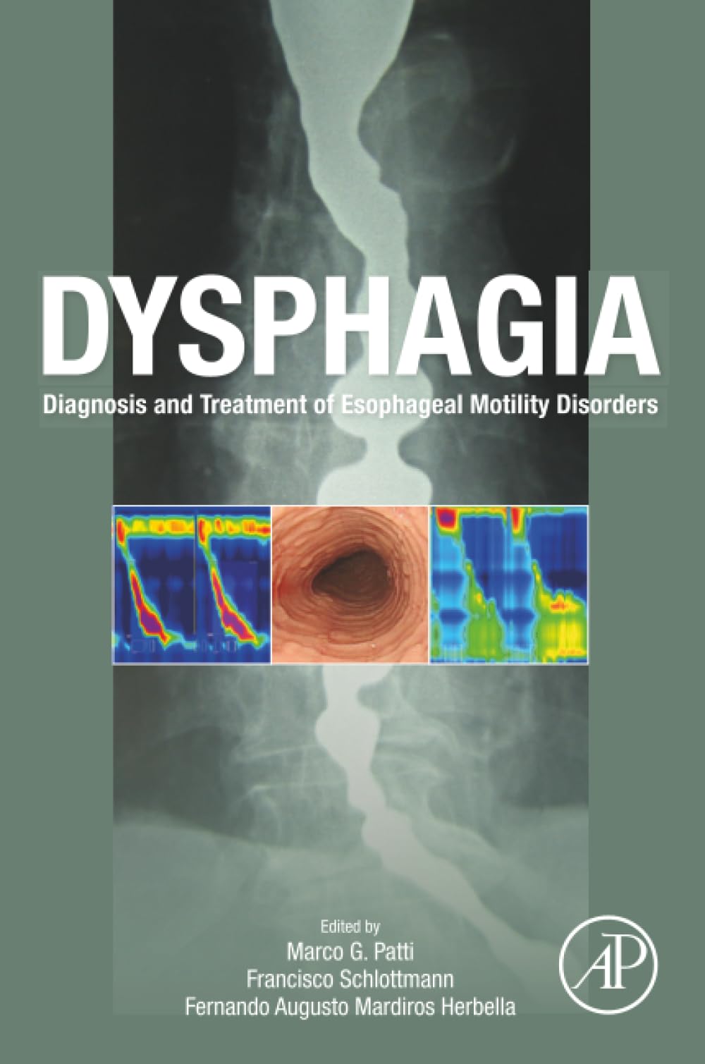 Dysphagia: Diagnosis and Treatment of Esophageal Motility Disorders