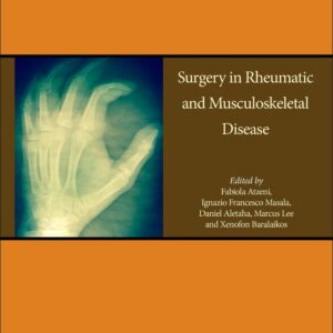 Surgery in Rheumatic and Musculoskeletal Disease (Volume 15) (Handbook of Systemic Autoimmune Diseases