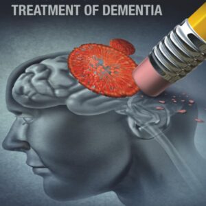 Nanomedicine-Based Approaches for the Treatment of Dementia
