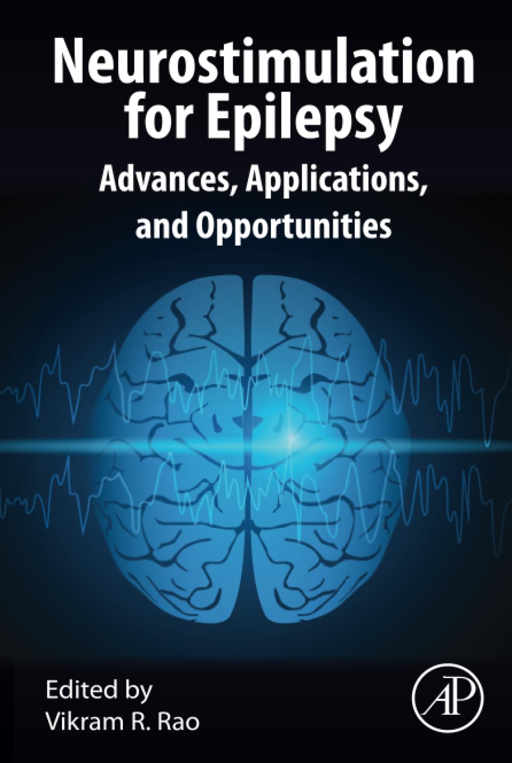 Neurostimulation for Epilepsy: Advances