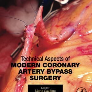 Technical Aspects of Modern Coronary Artery Bypass Surgery