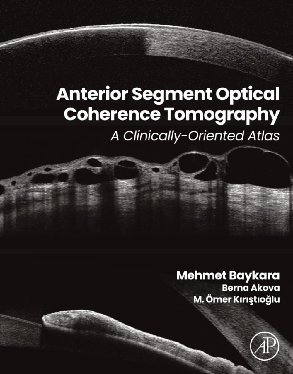 Anterior Segment Optical Coherence Tomography: A Clinically-Oriented Atlas
