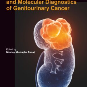 Immunological Implications and Molecular Diagnostics of Genitourinary Cancer