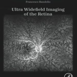 Ultra Widefield Imaging of the Retina