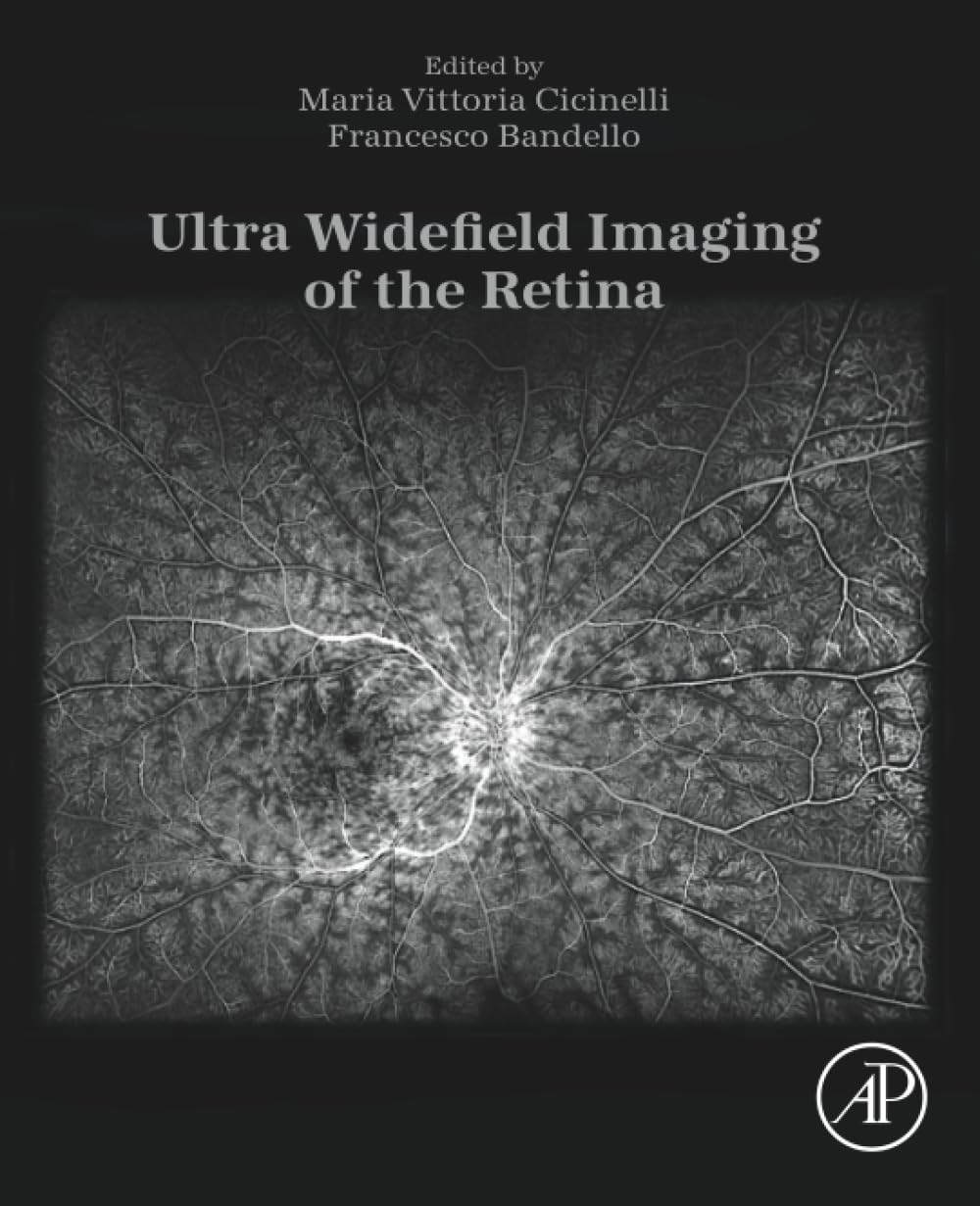 Ultra Widefield Imaging of the Retina