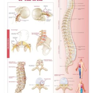 Anatomy and Injuries of The Spine: Anatomical Chart-ISBN: 9780781786669