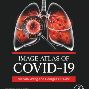 Image Atlas of COVID-19