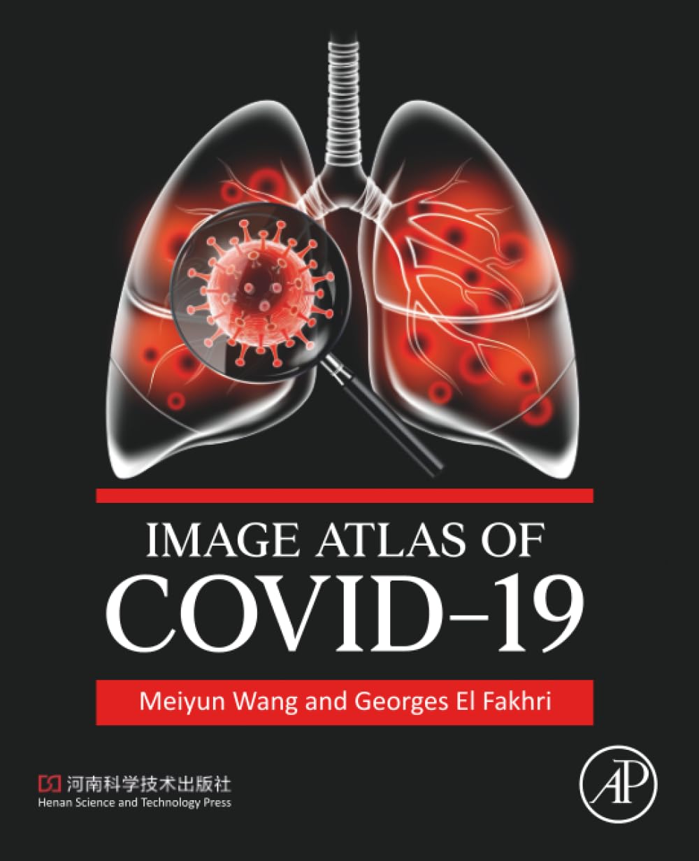Image Atlas of COVID-19