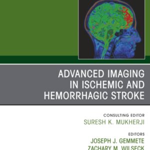 Advanced Imaging in Ischemic and Hemorrhagic Stroke