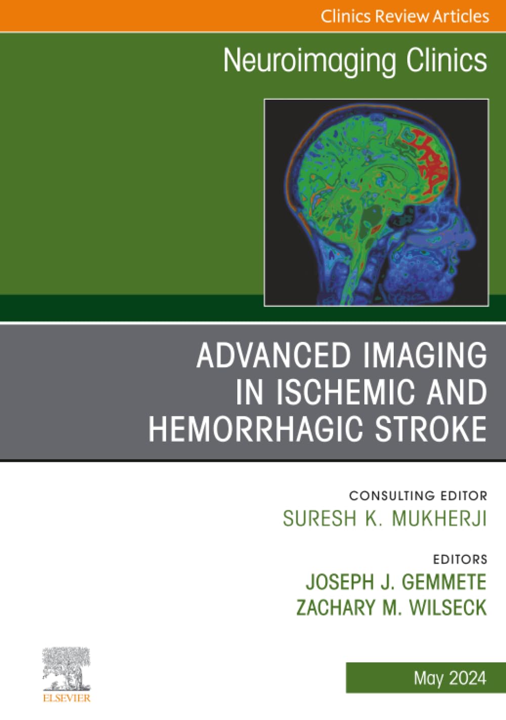 Advanced Imaging in Ischemic and Hemorrhagic Stroke