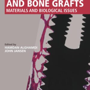 Dental Implants and Bone Grafts: Materials and Biological Issues