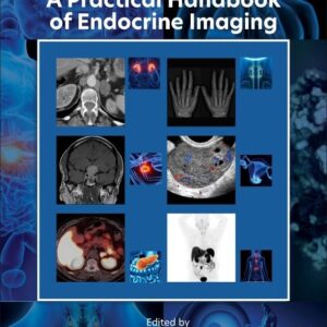 A Practical Handbook of Endocrine Imaging