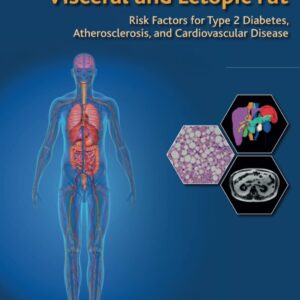 Visceral and Ectopic Fat: Risk Factors for Type 2 Diabetes