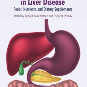 Dietary Interventions in Liver Disease: Foods
