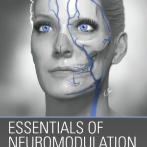 Essentials of Neuromodulation