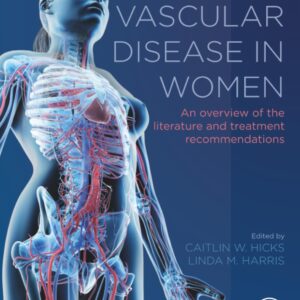 Vascular Disease in Women: An Overview of the Literature and Treatment Recommendations