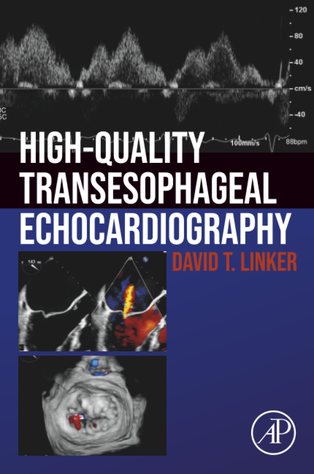 High-Quality Transesophageal Echocardiography