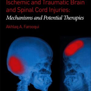 Ischemic and Traumatic Brain and Spinal Cord Injuries: Mechanisms and Potential Therapies