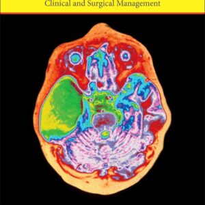 Arachnoid Cysts: Clinical and Surgical Management
