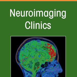 Imaging of the Post Treatment Head and Neck
